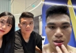 Hậu vệ từng 'nghèo nhất Việt Nam' chảy máu môi khi thi đấu, vợ không thương lại nói lời 'cay đắng' thế này đây