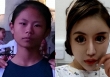 Cô gái nghiện làm đẹp từ năm 13 tuổi, chi 14 tỷ đồng để phẫu thuật thẩm mỹ, hiện tại hối hận nhưng đã muộn màng