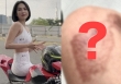 Ngọc Trinh zoom cận tình trạng những vết thương sau 4 tháng gặp tai nạn lái xe mô tô
