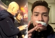 Hotboy đội tuyển Việt Nam phải khâu 24 mũi vì chấn thương, bố mẹ nghe tin khóc nghẹn vì thương con