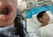 Vụ nam sinh cấp 2 bị bạn học ép uống nước sôi: Phía cơ quan chức năng đưa ra tuyên bố gây bất bình