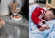 Bé gái 9 tuổi tổn thương xương khắp cơ thể, nghi ngờ khối u ác tính, nguyên nhân lại tìm thấy từ một con mèo hoang