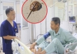 Biết so có độc nhưng vẫn ăn, người đàn ông phải nhập viện rửa dạ dày