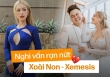 Toàn cảnh nghi vấn Xoài Non trục trặc Xemesis: Lộ nhiều dấu hiệu 'có biến', đôi bên đáp trả cực gắt nhưng vẫn lờ đi 1 vấn đề 