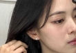 3 đặc điểm của sống mũi cảnh báo sức khỏe, thoái hóa đốt sống, rối loạn nội tiết nằm trong số đó