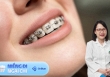 Niềng răng giúp giảm cân, liệu '1 mũi tên có trúng 2 đích'?