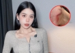 Đã có kết quả kiểm tra loạt thương tích của Hằng Du Mục