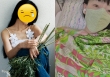 Nữ ca sĩ Gen Z bị liệt dây thần kinh sọ não