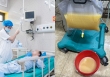 Người đàn ông ở Tuyên Quang phải lọc máu do viêm tuỵ cấp, hình ảnh xô chứa toàn mỡ được tách từ máu bệnh nhân khiến bác sĩ bất ngờ