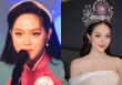 Ảnh phẫu thuật thẩm mỹ của hoa hậu Thanh Thuỷ gây sốt: Bác sĩ cảnh báo không phải ai cũng có thể làm