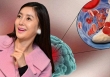 Nữ ca sĩ chia sẻ cơn ác mộng mang tên 'vỡ mạch máu não ở tuổi 34': Bắt đầu là những cơn đau đầu 'dữ dội như sét đánh'