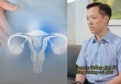 Có 'thuốc bổ trứng' không? Bác sĩ nói thẳng một điều, nhiều phụ nữ chợt hiểu vì sao mình uống mãi vẫn khó có con