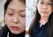 Người phụ nữ lão hóa nhanh như tụt dốc không phanh chỉ trong 20 ngày