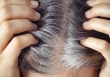 Mỗi sợi tóc bạc có thể là dấu hiệu cơ thể tự bảo vệ khỏi ung thư