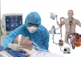ECMO là gì, TP.HCM có thiếu máy ECMO không?