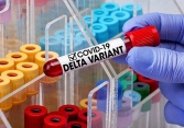 Delta - Biến thể mạnh nhất và đáng sợ nhất mà thế giới đang phải đối mặt