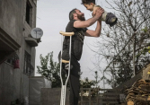 Khoảnh khắc buồn vui lẫn lộn về bức ảnh hai cha con bị mất tứ chi do nội chiến ở Syria
