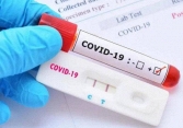 TP.HCM, Kiên Giang kiểm tra đột xuất việc mua bán kit test COVID-19