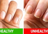 8 dấu hiệu cảnh báo cơ thể có vấn đề về sức khỏe không nên bỏ qua