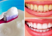 10 cách tốt nhất để làm trắng răng bị ố vàng tại nhà
