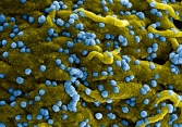 WHO cảnh báo về một virus gây chết người xuất hiện ở châu Phi