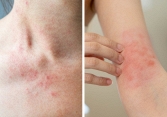Nếu thấy một trong những dấu hiệu này, nghĩa là cơ thể đang cảnh báo sức khỏe có vấn đề