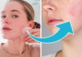7 sản phẩm chăm sóc có thể gây hại cho da, rất nhiều người không biết