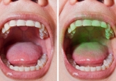 5 mẹo đơn giản để có được hơi thở thơm tho