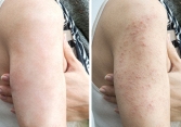 Điều gì sẽ xảy ra với cơ thể nếu bạn ngồi quá nhiều