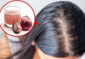 8 biện pháp khắc phục tình trạng rụng tóc