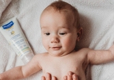 Cách điều trị và chăm sóc viêm da cơ địa vào mùa hè