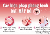 Bệnh đau mắt đỏ đang gia tăng, cần làm gì để phòng bệnh?