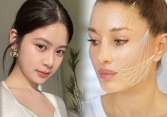 Thực hư công nghệ căng chỉ 3D, 4D, 5D được bác sĩ da liễu tiết lộ