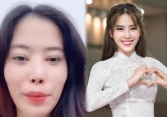 Thẩm mỹ lỗi chi tiết nào trên gương mặt mà khiến Nam Em ngày càng khác lạ và lời khuyên của chuyên gia khi làm đẹp