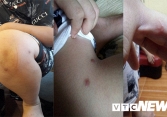 Nghi vấn bé trai bị bố và mẹ kế bạo hành dã man: Bắt quỳ lên gạch vỡ, bật lửa đốt chân