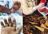 Đốt thuốc bắc xông nhà, 1 người suýt tử vong vì ngộ độc thạch tín 