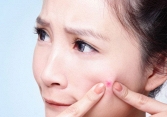Mẹo chăm sóc da đúng cách sau khi nặn mụn