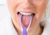 7 cách loại bỏ vi khuẩn gây sâu răng và hôi miệng tại nhà hiệu quả nhất