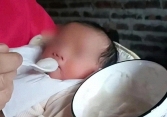 Sỏi thận ở bé 5 tháng tuổi, lời cảnh tỉnh đau lòng về sai lầm nuôi con truyền thống