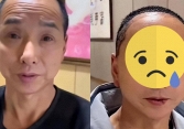Người đàn ông “lột xác” sau phẫu thuật thẩm mỹ: Nhìn trẻ ra 30 tuổi nhưng ai cũng sợ khi thấy thứ này 