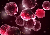 Virus đậu mùa bò có thể tiêu diệt mọi loại ung thư