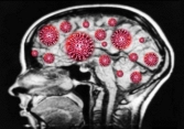 Nghiên cứu mới: Virus Covid-19 có thể xâm nhập vào não