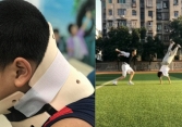 Bé trai 10 tuổi bị vẹo cổ vì học theo trò nhào lộn trên Tik Tok