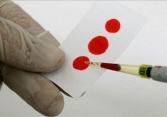 Nga tạo ra nguyên mẫu vaccine phòng bệnh AIDS