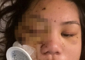 Một cô gái gốc Á bị bắn vào mặt ở Mỹ