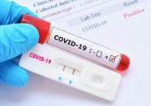 Bộ Y tế chính thức lên tiếng về việc bộ kit test nhanh COVID-19 có giá chênh lệch 