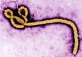 Nghiên cứu mới: Virus Ebola có thể “ẩn náu” trong cơ thể chờ ngày 'kích hoạt'