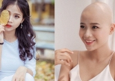 Cô gái chiến thắng ung thư tham gia thi 'Miss World Vietnam'