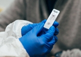 Tại sao vạch test nhanh Covid-19 có lúc mờ lúc nhạt?