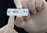 Sau khi tiếp xúc F0, nên test khi nào để có kết quả chuẩn nhất?